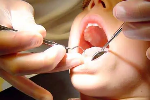 Mitos e verdades na odontologia