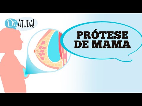 PRÓTESE DE MAMA: PRINCIPAIS DÚVIDAS