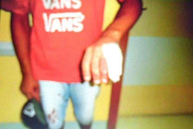 Jovem de 16 anos é alvejado com dois tiros próximo a Barragem do Rio São Bento 1 Jovem de 16 anos é alvejado com dois tiros próximo a Barragem do Rio São Bento