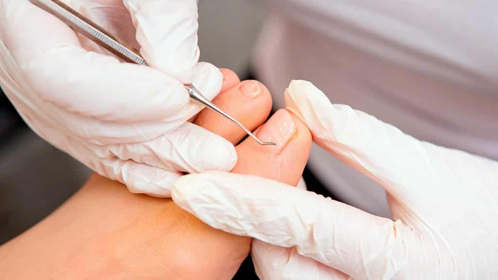 Unesc abre inscrições para curso técnico em Podologia e Segurança do Trabalho 1 Unesc abre inscrições para curso técnico em Podologia e Segurança do Trabalho