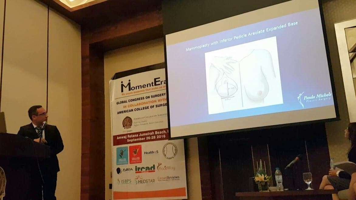 Cirurgião Plástico de Criciúma fala sobre técnica de mamoplastia redutora em Dubai 1 Cirurgião Plástico de Criciúma fala sobre técnica de mamoplastia redutora em Dubai
