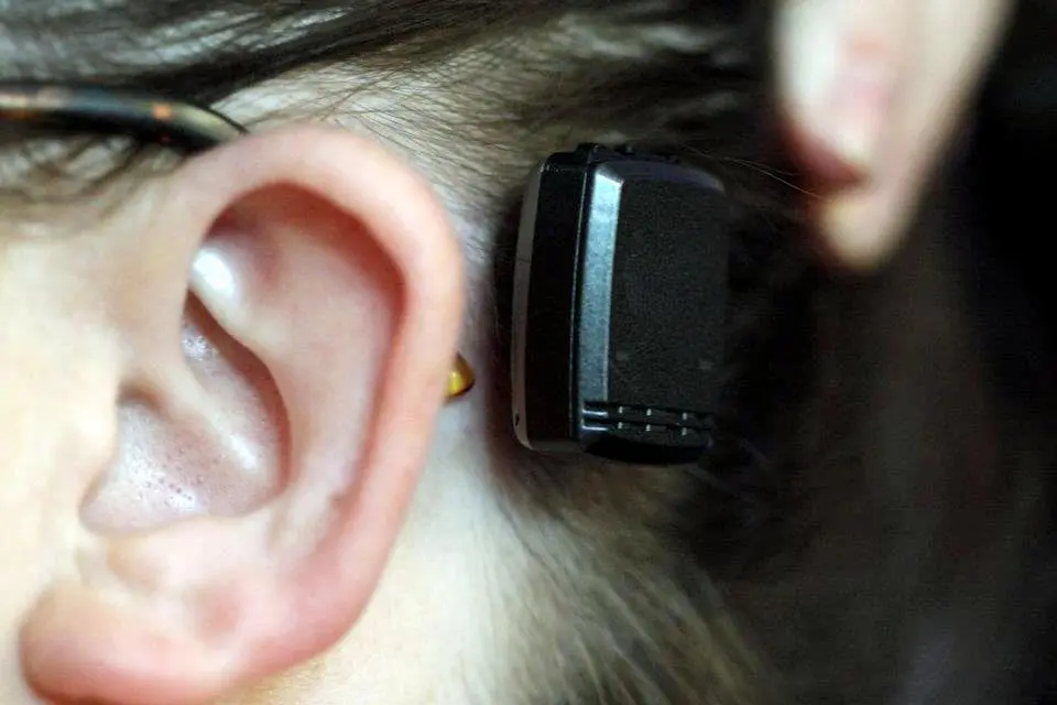 Nova tecnologia é utilizada em implante de prótese auditiva