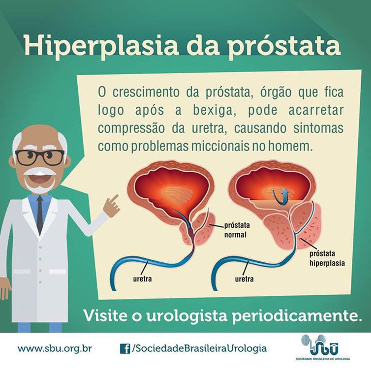 Um em cada seis homens tem câncer de próstata no Brasil, alerta Inca