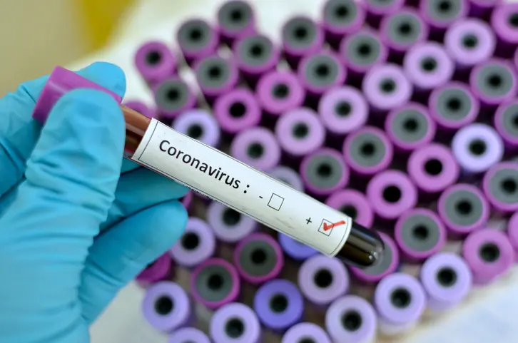 Mais dois casos de coronavírus em Siderópolis: agora são dez casos confirmados