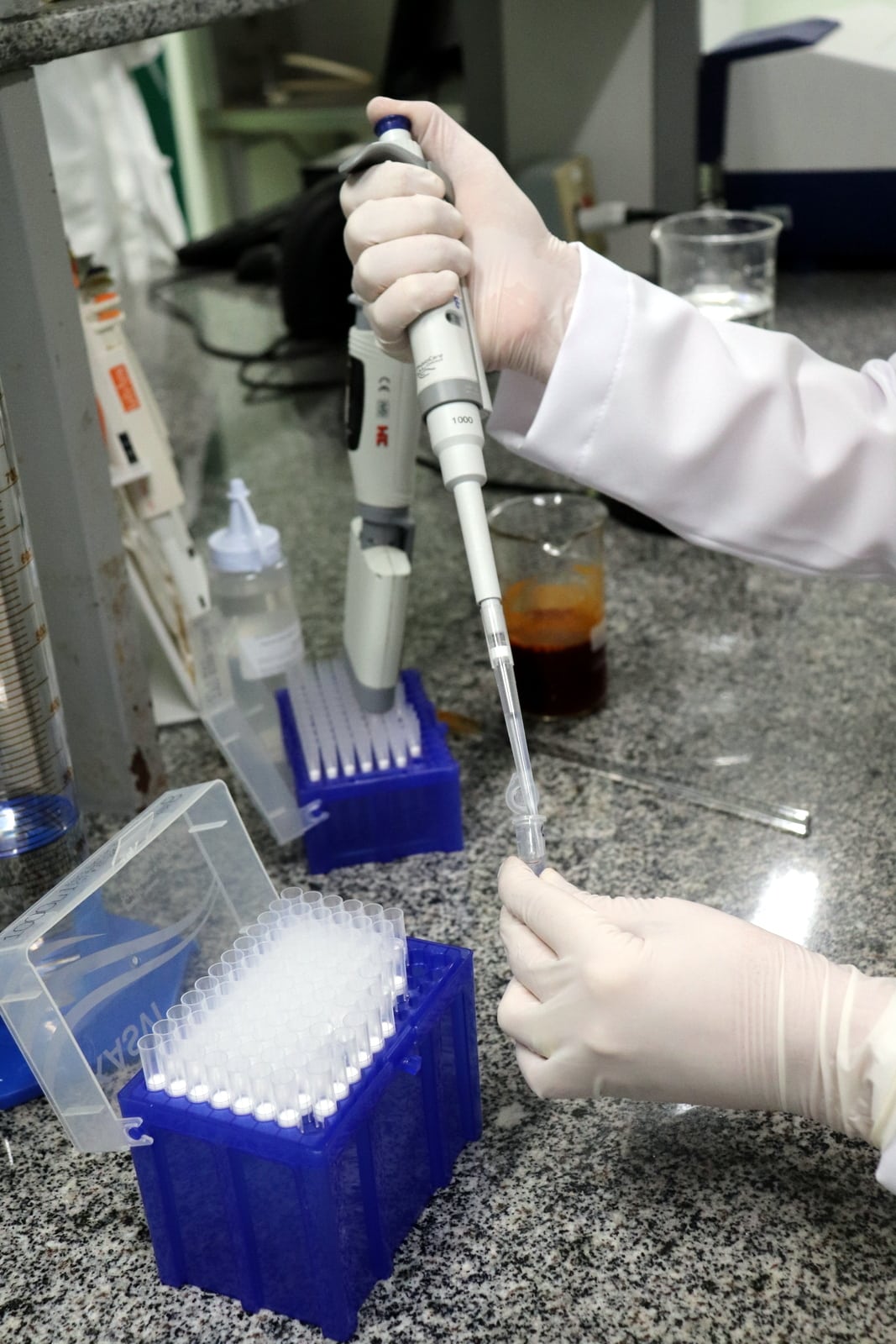 Unesc inicia em setembro coleta de dados de pesquisa para avaliar danos neuropsiquiátricos relacionados à Covid-19 5 Unesc inicia em setembro coleta de dados de pesquisa para avaliar danos neuropsiquiátricos relacionados à Covid-19