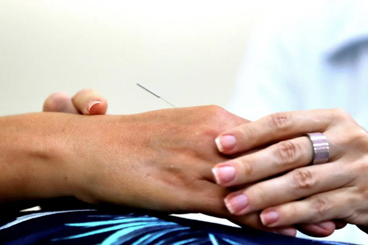 Novo projeto da Unesc oferece atendimento gratuito em acupuntura e práticas integrativas
