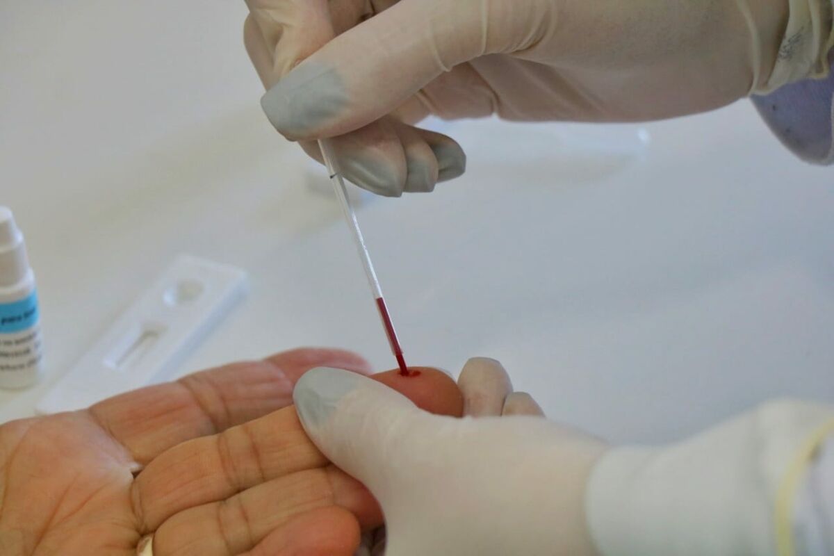 Secretaria de Saúde reforça testes de hepatite nesta semana
