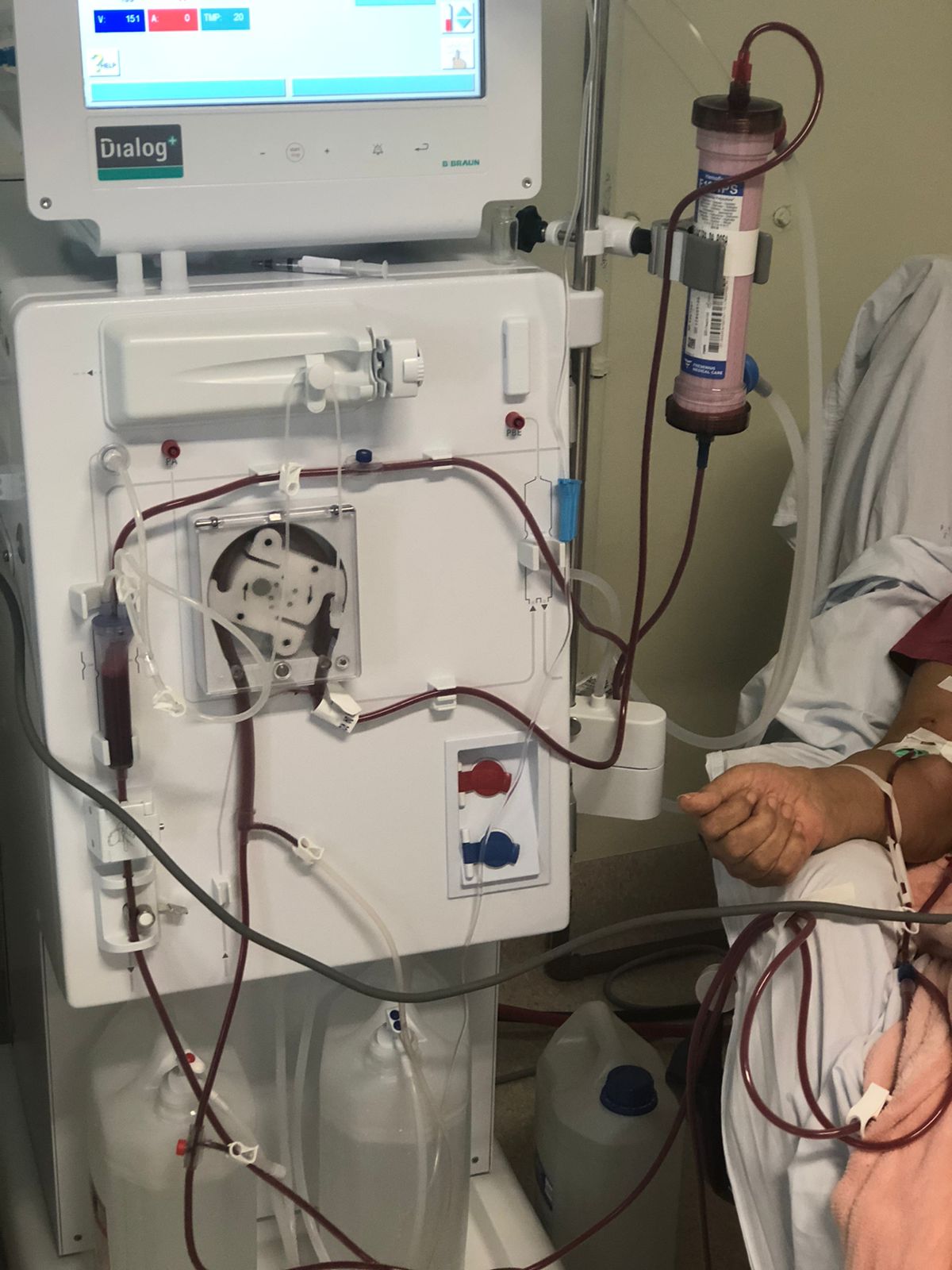 HSJosé presta atendimento de excelência ao paciente renal crônico 3 HSJosé presta atendimento de excelência ao paciente renal crônico