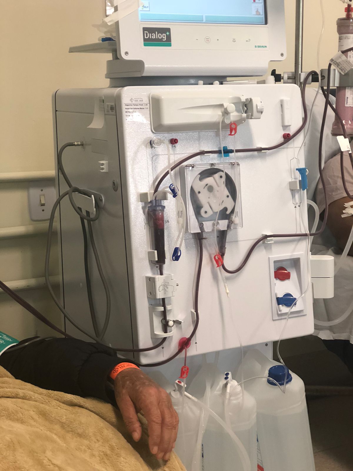 HSJosé presta atendimento de excelência ao paciente renal crônico 4 HSJosé presta atendimento de excelência ao paciente renal crônico
