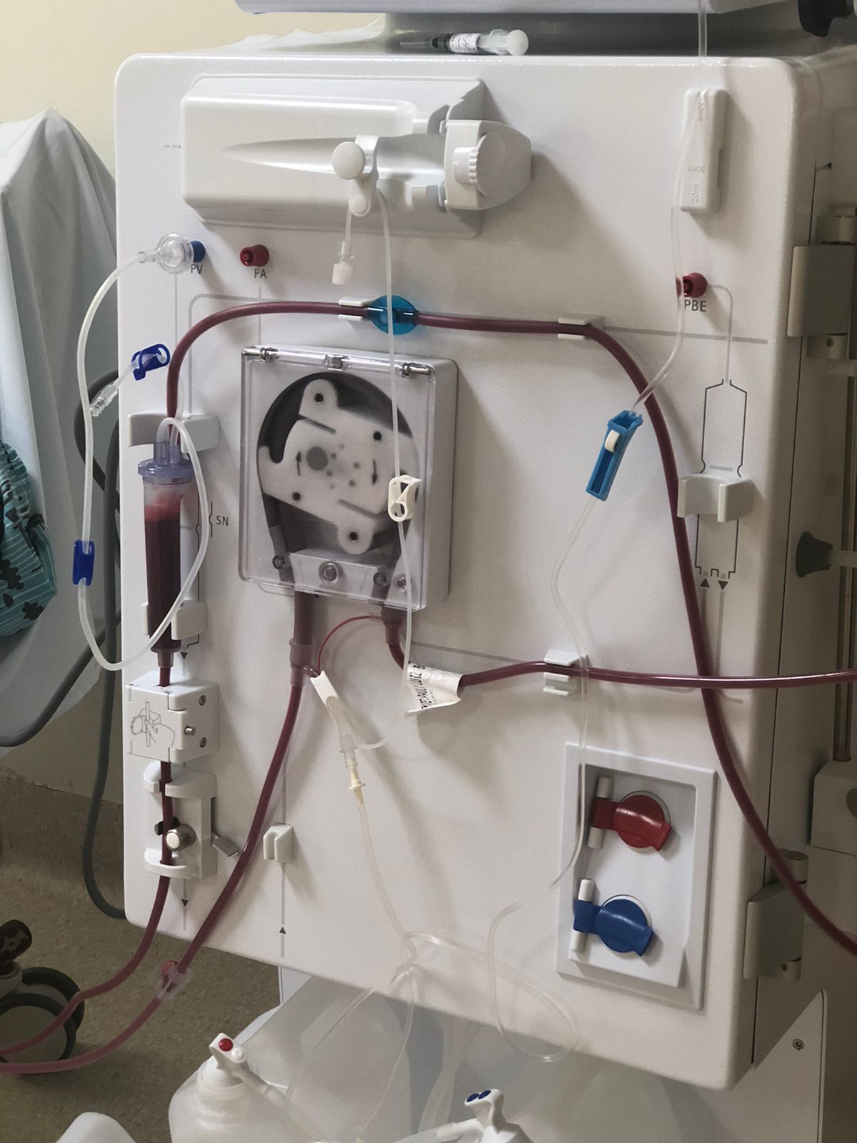 HSJosé presta atendimento de excelência ao paciente renal crônico 1 HSJosé presta atendimento de excelência ao paciente renal crônico
