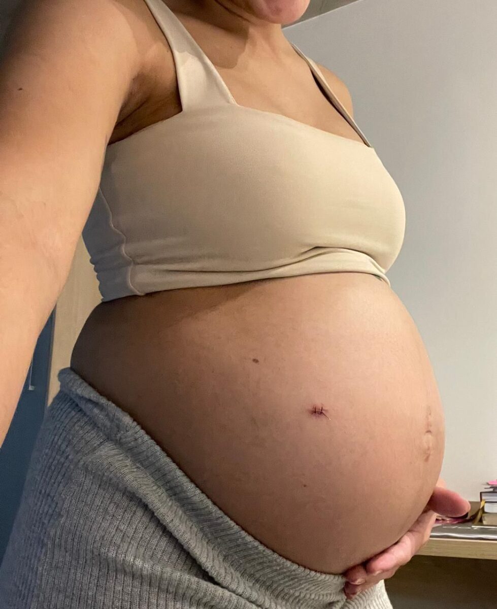 Amor além do útero: casal luta pela vida da filha ainda no ventre da mãe 1 Amor além do útero: casal luta pela vida da filha ainda no ventre da mãe