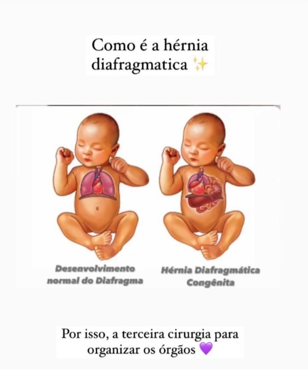 Amor além do útero: casal luta pela vida da filha ainda no ventre da mãe 5 Amor além do útero: casal luta pela vida da filha ainda no ventre da mãe